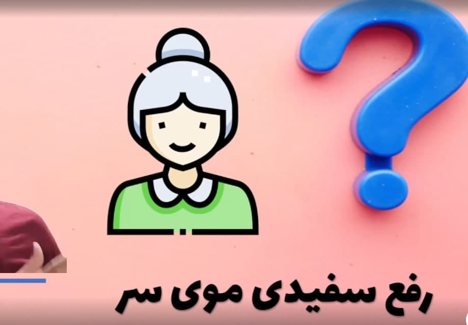 رفع سفیدی موی سر و درمان آن با ارائه راهکارهای متخصصین